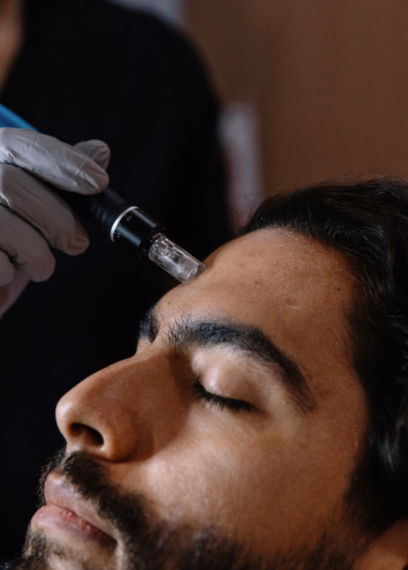 A microneedling pen held against a client's cheek, her eyes closed, in warm lamplight